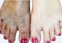 Esta es la foma mas facil de acalrar los pies y las manos.