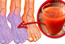 ¿Mala Circulación?… ¿Manos Y Pies Fríos? Esto Es Lo Que Necesitas Para Resolverlo.