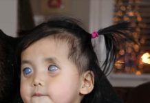 Nació con ojos plateados y la abandonaron en un orfanato. Él, al ver su foto, verás cómo luce hoy.