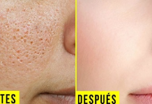 CIERRA LOS POROS ABIERTOS PARA SIEMPRE.