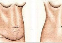 La mejor receta: seca la barriga en solo días; de las mejores que he visto!