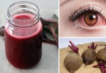 RECUPERA LA VISTA BORROSA, TRABAJA MIOPIA Y CATARATAS.