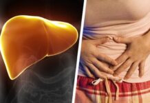 CUIDADO! Si presentas alguno de estos síntomas, tu hígado puede estar enfermo.