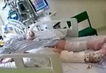 Médico desconecta respirador de joven: Entonces algo se mueve debajo de la colcha.