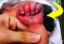 Enfermera pensó que la mamá estaba besando a su bebé. ¡Pero, al mirar más de cerca, casi se desmaya!