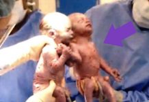 Estas gemelas se agarraron de la mano al nacer… ¡Y ahora son inseparables!